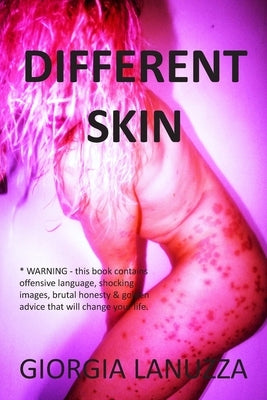 Different Skin by Lanuzza, Giorgia