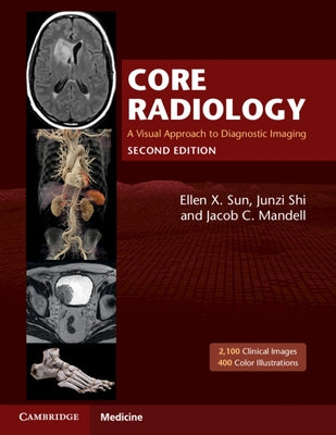 Core Radiology: A Visual Approach to Diagnostic Imaging by Sun, Ellen X.