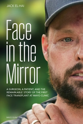 Face in the Mirror: A Surgeon, a Patient, and the Remarkable Story of the First Face Transplant at Mayo Clinic by El-Hai, Jack