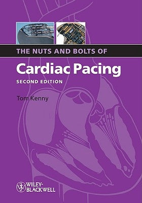 Nuts Bolts Cardiac Pacing 2e by Kenny, Tom
