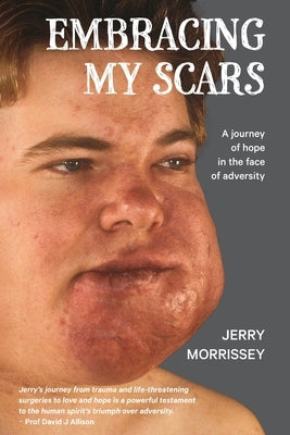 Embracing My Scars: A journey of hope in the face of adversity by Morrissey, Jerry