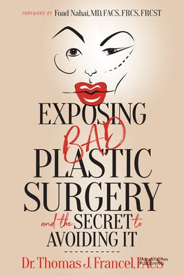 Exposing Bad Plastic Surgery: And the Secret to Avoiding It by Francel, Thomas J.