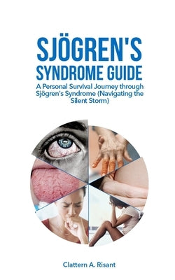 Sjögren's Syndrome Guide: A Personal Survival Journey through Sjögren's Syndrome (Navigating the Silent Storm) by A. Risant, Clattern