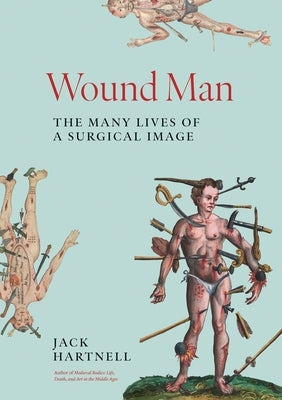 Wound Man: The Many Lives of a Surgical Image by Hartnell, Jack