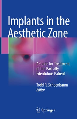 Implants in the Aesthetic Zone: A Guide for Treatment of the Partially Edentulous Patient by Schoenbaum, Todd R.