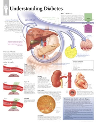 Understanding Diabetes Chart: Laminated Wall Chart by Scientific Publishing