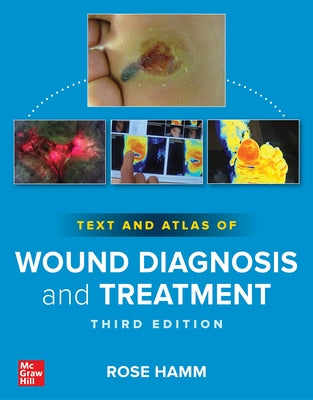 Text and Atlas of Wound Diagnosis and Treatment, Third Edition by Hamm, Rose