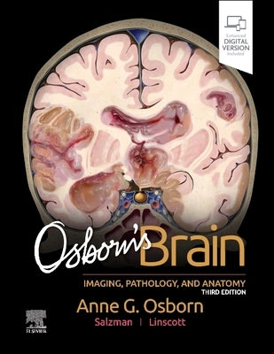 Osborn's Brain by Osborn, Anne G.