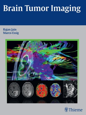 Brain Tumor Imaging by Jain, Rajan