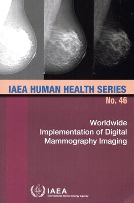 Worldwide Implementation of Digital Mammography Imaging by International Atomic Energy Agency