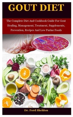 Gout Diet: The Complete Diet And Cookbook Guide For Gout Healing, Management, Treatment, Supplements, Prevention, Recipes And Low by Sheldon, Ford