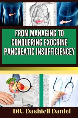 From Managing to Conquering Exocrine Pancreatic Insufficiencey: Expert guide to Understanding EPI Causes, Decoding Symptoms, and Navigating Treatment by Daniel, Dashiell