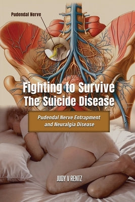 Fighting to Survive The Suicide Disease: Pudendal Nerve Entrapment and Neuralgia Disease by V. Rentz, Judy