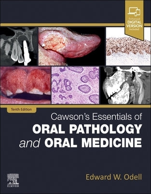 Cawson's Essentials of Oral Pathology and Oral Medicine by Odell, Edward W.