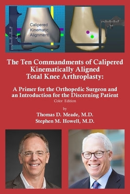 The Ten Commandments of Calipered Kinematically Aligned Total Knee Arthroplasty by Meade, Thomas D.
