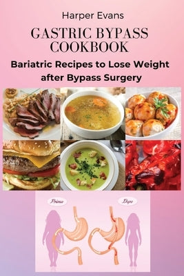 Gastric Bypass Cookbook: Bariatric Recipes to Lose Weight after Bypass Surgery by Harper Evans