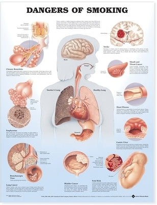 Dangers of Smoking Anatomical Chart by Anatomical Chart Company