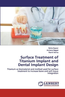 Surface Treatment of Titanium Implant and Dental Implant Design by Kapoor, Nisha