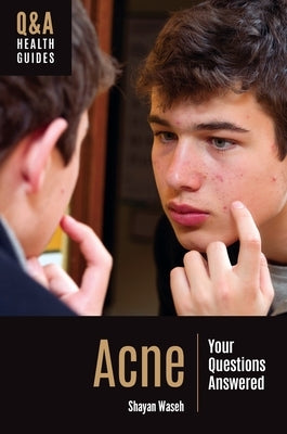 Acne: Your Questions Answered by Waseh, Shayan
