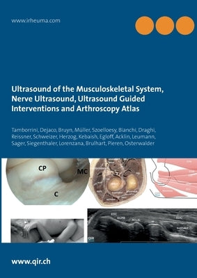 Ultrasound of the Musculoskeletal System, Nerve Ultrasound, Ultrasound Guided Interventions and Arthroscopy Atlas: Musculoskeletal Sonoanatomy Guideli by Tamborrini, Giorgio