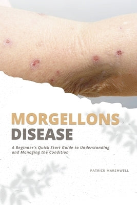 Morgellons Disease: A Beginner's Quick Start Guide to Understanding and Managing the Condition by Marshwell, Patrick