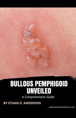 Bullous Pemphigoid Unveiled: A Comprehensive Guide by Anderson, Ethan D.