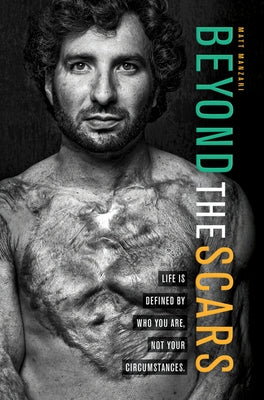 Beyond the Scars: Life Is Defined by Who You Are, Not Your Circumstances by Manzari, Matt