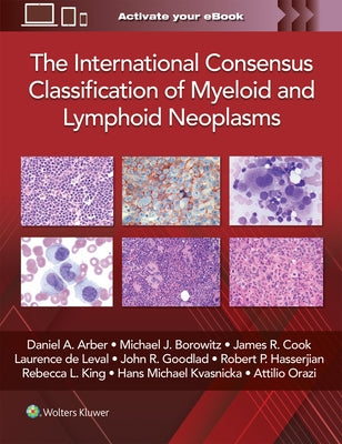 The International Consensus Classification of Myeloid and Lymphoid Neoplasms by Arber, Daniel A.