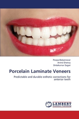 Porcelain Laminate Veneers by Babannavar, Roopa