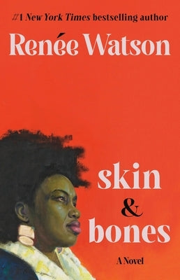 Skin & Bones by Watson, Ren&#195;&#169;e