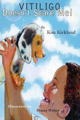 Vitiligo Doesn't Scare Me by Kirkland, Kim