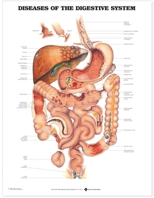 Diseases of the Digestive System Anatomical Chart by Anatomical Chart Company