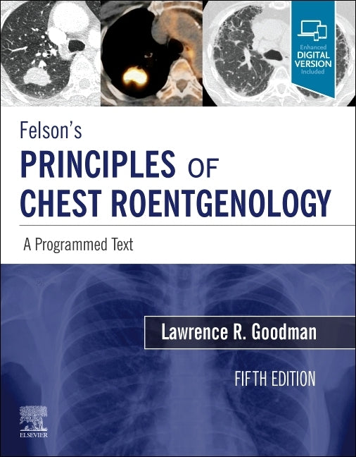 Felson's Principles of Chest Roentgenology, a Programmed Text: A Programmed Text by Goodman, Lawrence R.