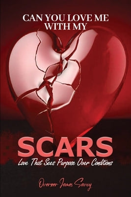 Can You Love Me With My Scars by Savoy, James G.