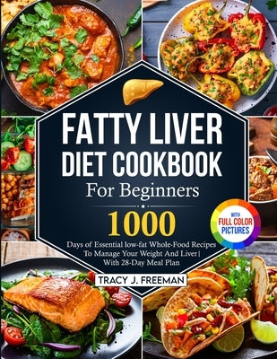 Fatty Liver Diet Cookbook For Beginners: 1000 days of Essential low-fat Whole-Food Recipes To Manage Your Weight And Liver With 28-Day Meal Plan With by Freeman, Tracy J.