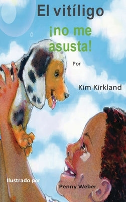 El vitiligo no me asusta by Kirkland, Kim