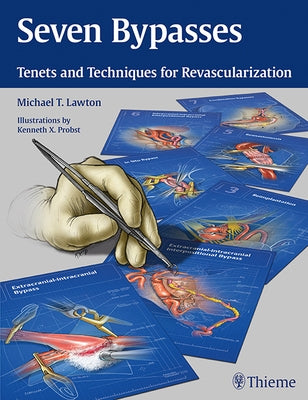 Seven Bypasses: Tenets and Techniques for Revascularization by Lawton, Michael T.