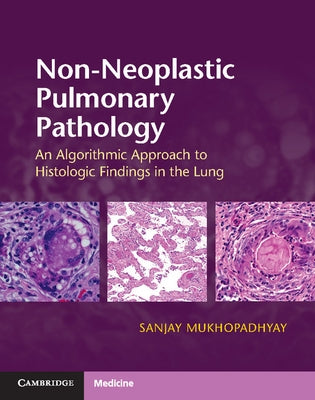 Non-Neoplastic Pulmonary Pathology with Online Resource: An Algorithmic Approach to Histologic Findings in the Lung by Mukhopadhyay, Sanjay