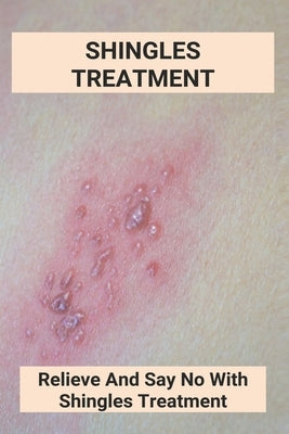 Shingles Treatment: Relieve And Say No With Shingles Treatment: Shingles On Face Treatment by Tomasic, Columbus