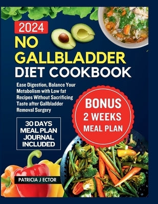 No Gallbladder Diet Cookbook: Ease Digestion, Balance Your Metabolism with Low fat Recipes Without Sacrificing Taste after Gallbladder Removal Surge by J. Ector, Patricia