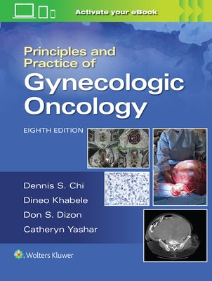 Principles and Practice of Gynecologic Oncology by Chi, Dennis