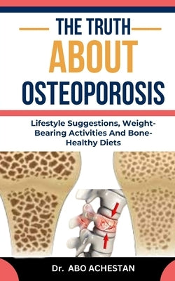 The Truth about Osteoporosis: Lifestyle Suggestions, Weight-Bearing Activities And Bone-Healthy Diets by Achestan, Abo