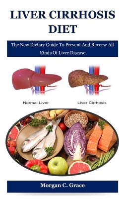 Liver Cirrhosis Diet: The New Dietary Guide To Prevent And Reverse All Kinds Of Liver Disease by C. Grace, Morgan