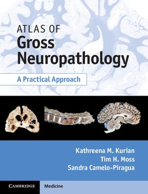 Atlas of Gross Neuropathology Book and Online Bundle: A Practical Approach [With eBook] by Kurian, Kathreena M.