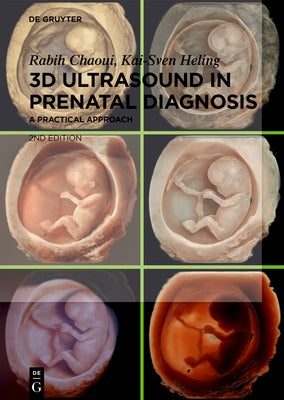 3D Ultrasound in Prenatal Diagnosis: A Practical Approach by Chaoui, Rabih