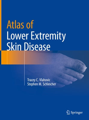 Atlas of Lower Extremity Skin Disease by Vlahovic, Tracey C.