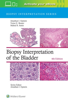 Biopsy Interpretation of the Bladder by Epstein, Jonathan I.