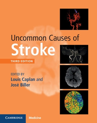 Uncommon Causes of Stroke by Caplan, Louis