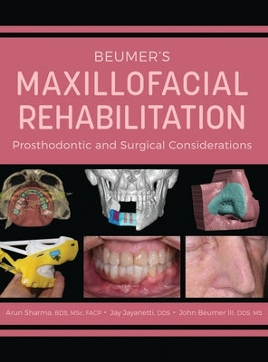 Beumer's Maxillofacial Rehabilitation: Prosthodontics and Surgical Considerations by Sharma, Arun