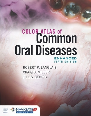 Color Atlas of Common Oral Diseases, Enhanced Edition by Langlais, Robert P.